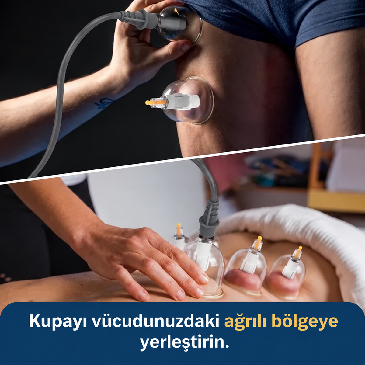 12'li Profesyonel Vakumlu Hacamat Kupa Seti - Doğal Terapi ve Ağrı Hafifletici Masaj Aleti